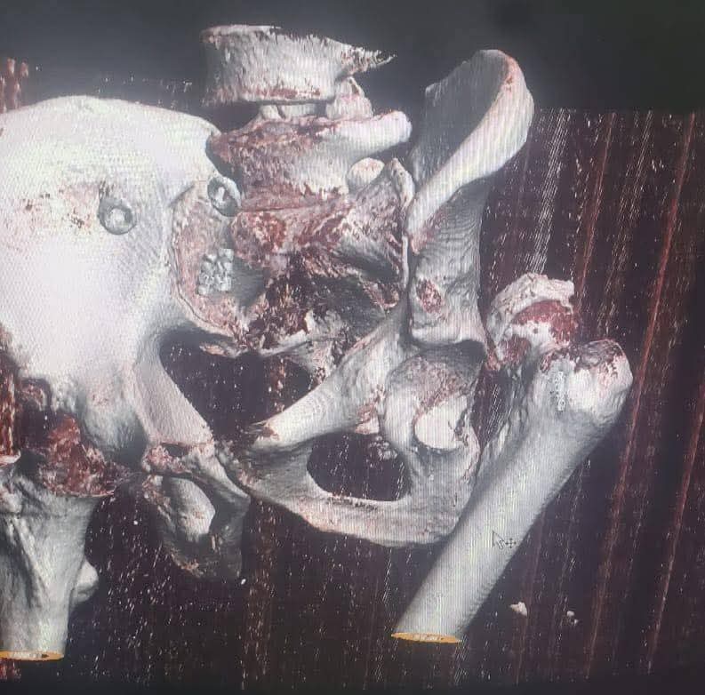 FB_IMG_1746473954344