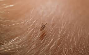 تفسير حلم نزع القمل من الشعر للمتزوجة لابن سيرين